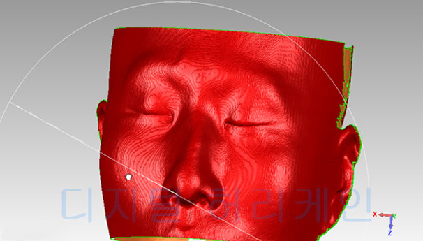 북한 3D 프린터 의료 분야에 이용